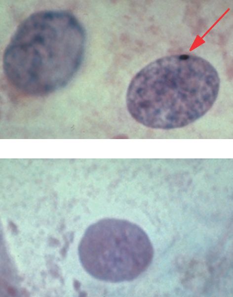 battle-of-the-sexes-the-wonders-of-sex-chromosomes-namuhyou