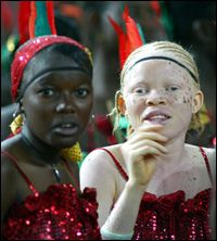 pku albinism